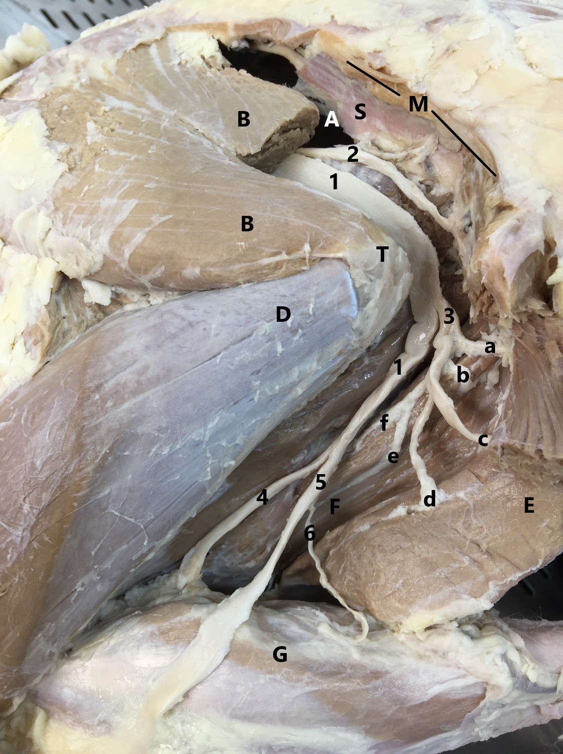 Sciatic nerve and its main branches